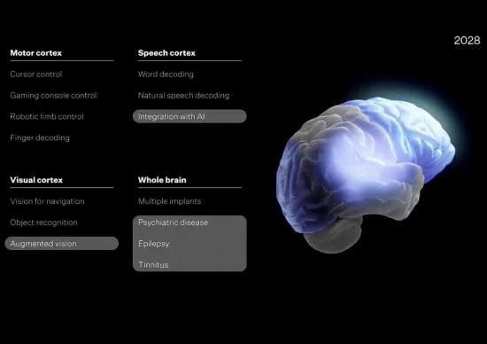 图片来源：Neuralink官网